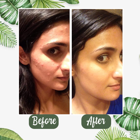 Green Tea Deep Cleanse Mask Stick - YN