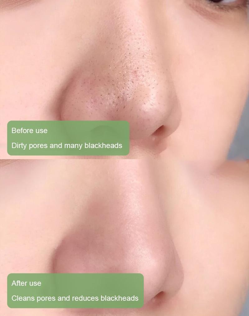 Green Tea Deep Cleanse Mask Stick - YN