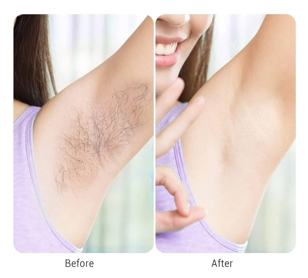 Sensitive Skin Hair Trimmer – Portable, Quiet & Easy to Use - YN