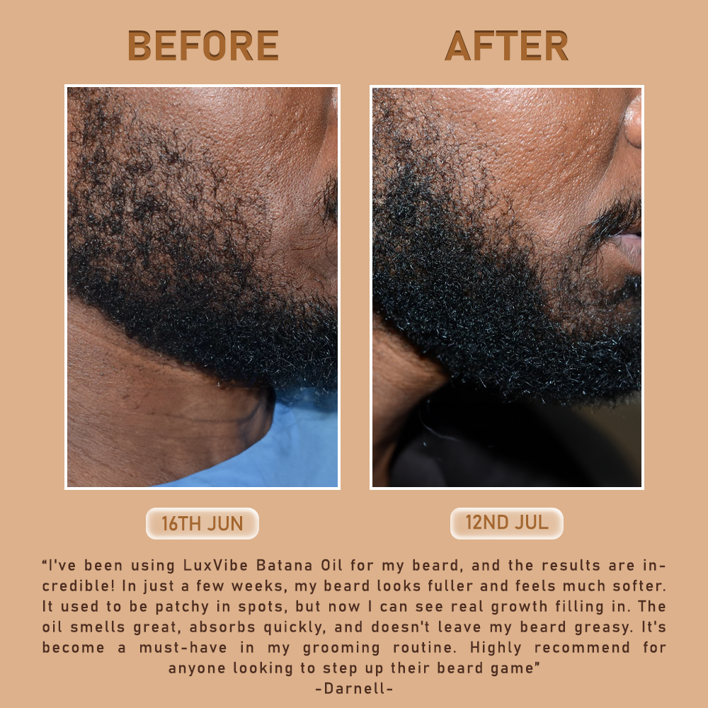Batana Natural Hair Growth Oil - YN
