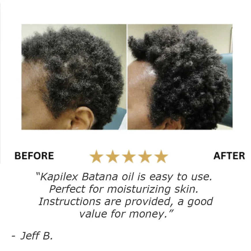 Batana Natural Hair Growth Oil - YN