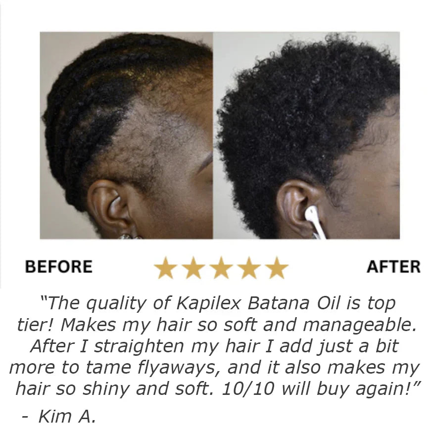 Batana Natural Hair Growth Oil - YN